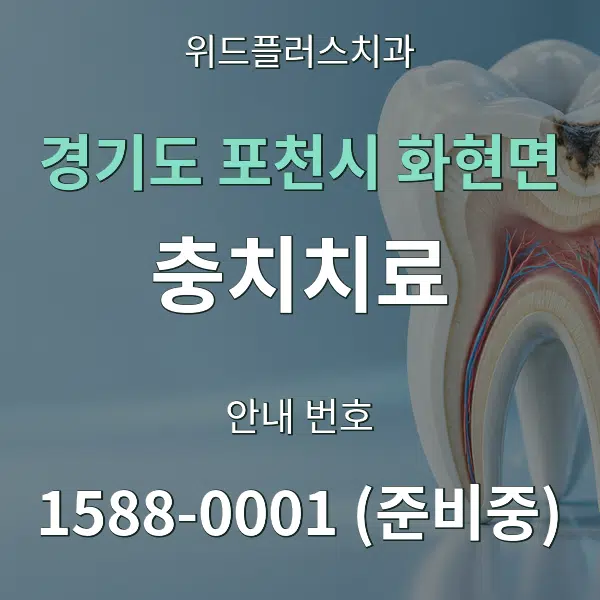 경기도 포천시 화현면 충치치료 대표 안내 그래픽