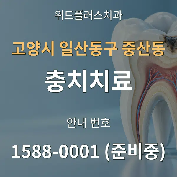 고양시 일산동구 중산동 충치치료 대표 안내 그래픽