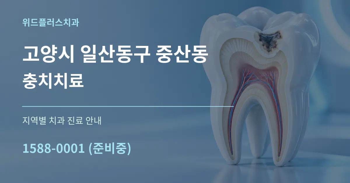 고양시 일산동구 중산동 충치치료 대표 안내 그래픽