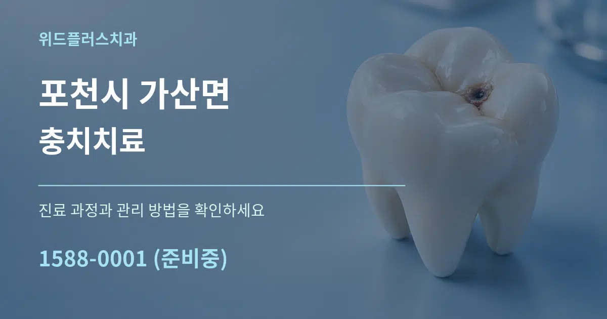 포천시 가산면 충치치료 작업 조건 안내 그래픽