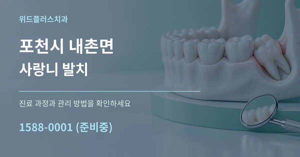 포천시 내촌면 사랑니 발치 작업 조건 안내 그래픽