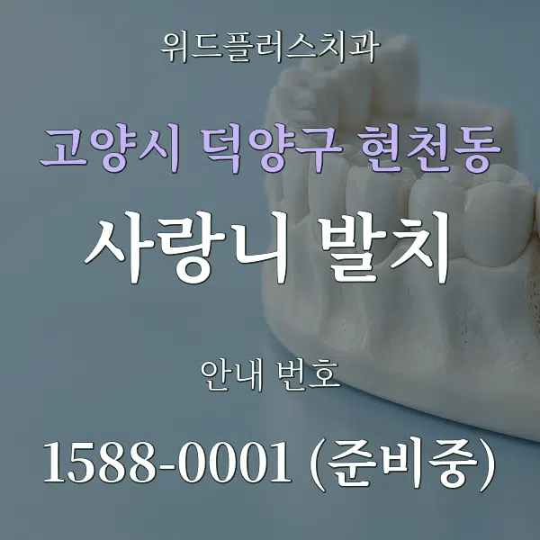 고양시 덕양구 현천동 사랑니 발치 대표 안내 그래픽