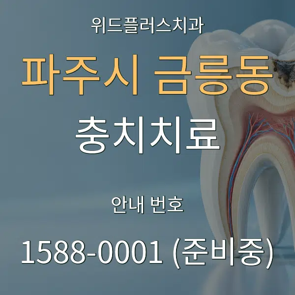 파주시 금릉동 충치치료 대표 안내 그래픽