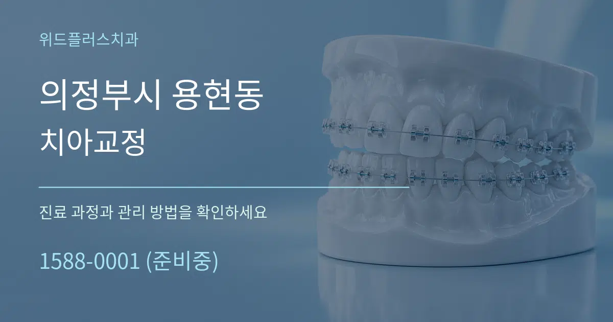 의정부시 용현동 치아교정 작업 조건 안내 그래픽