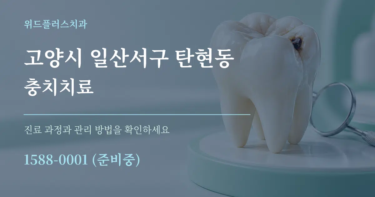 고양시 일산서구 탄현동 충치치료 서비스 이용 안내 그래픽
