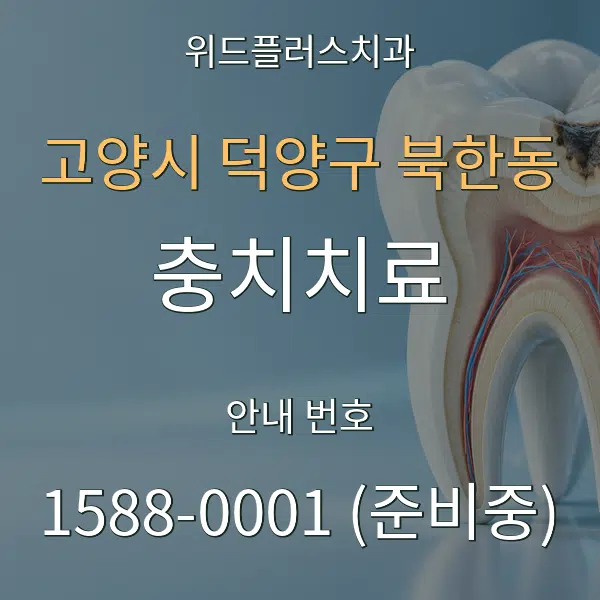 고양시 덕양구 북한동 충치치료 대표 안내 그래픽