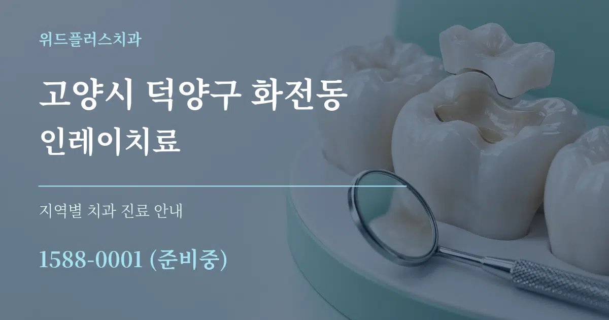고양시 덕양구 화전동 인레이치료 대표 안내 그래픽