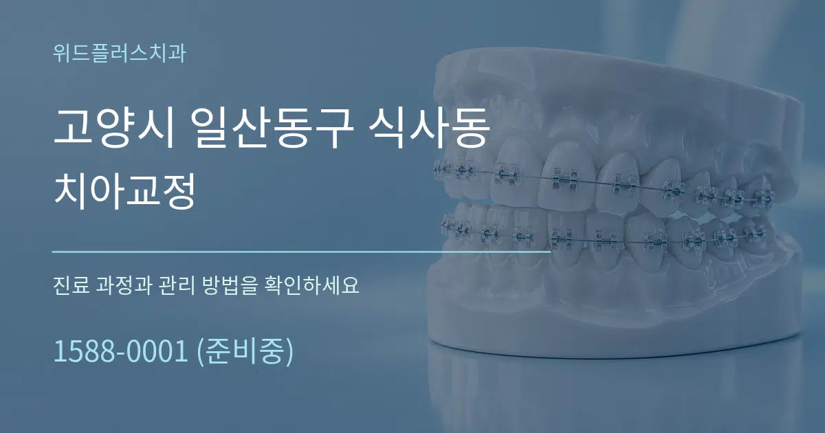 고양시 일산동구 식사동 치아교정 작업 조건 안내 그래픽