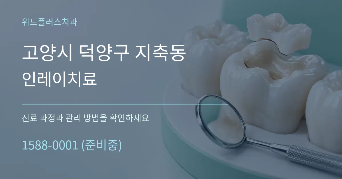고양시 덕양구 지축동 인레이치료 서비스 이용 안내 그래픽
