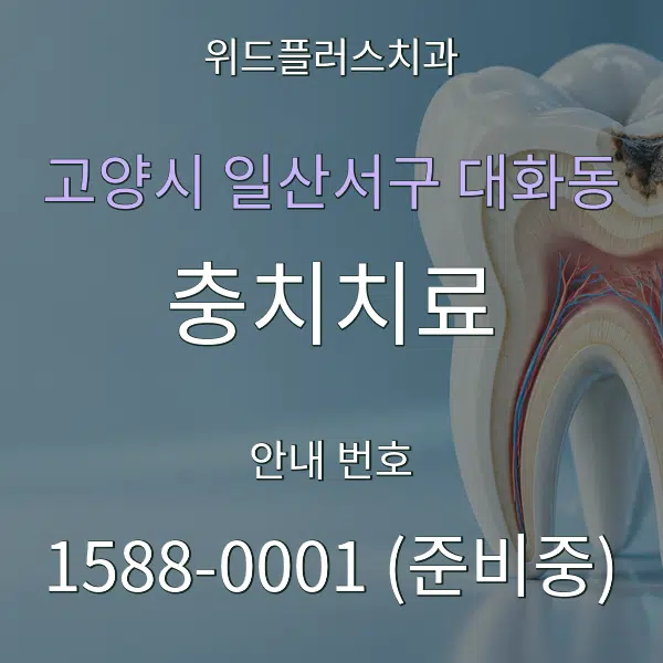고양시 일산서구 대화동 충치치료 대표 안내 그래픽