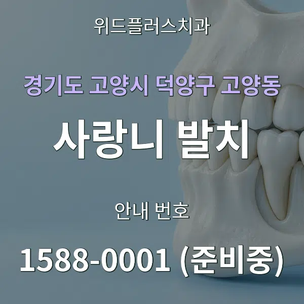 경기도 고양시 덕양구 고양동 사랑니 발치 대표 안내 그래픽