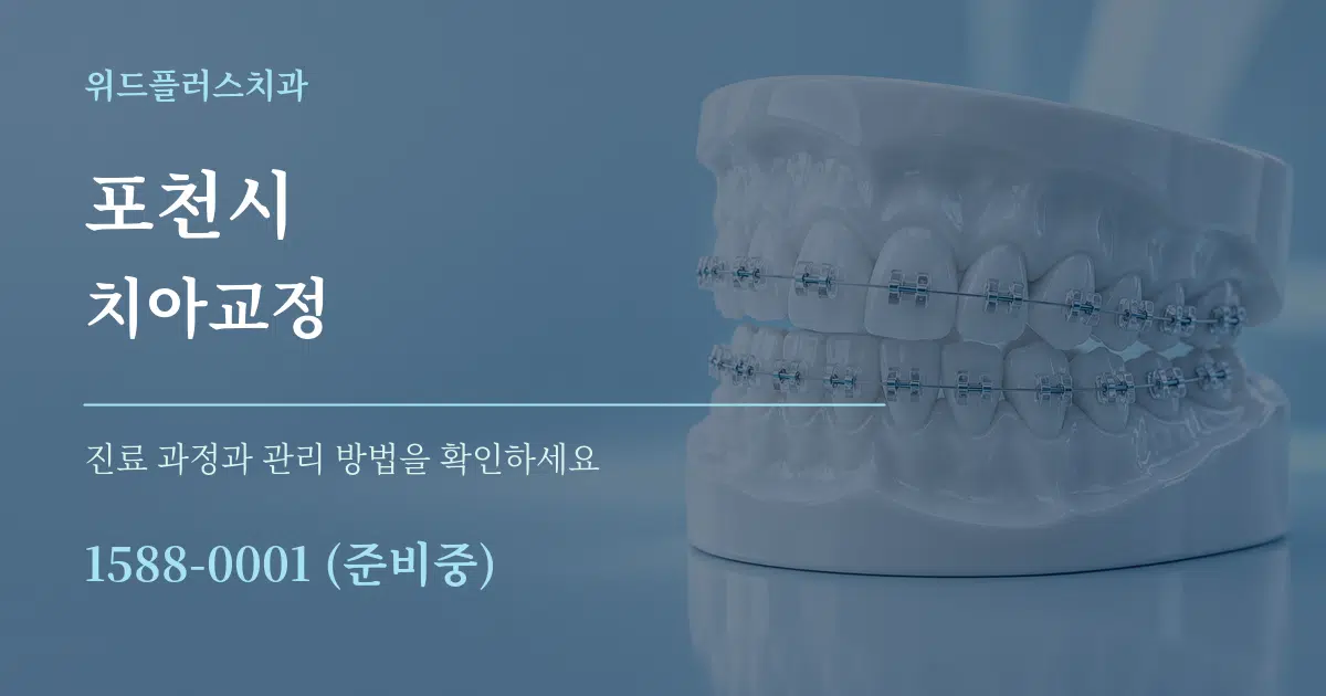 포천시 치아교정 작업 조건 안내 그래픽
