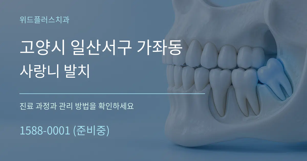 고양시 일산서구 가좌동 사랑니 발치 작업 조건 안내 그래픽