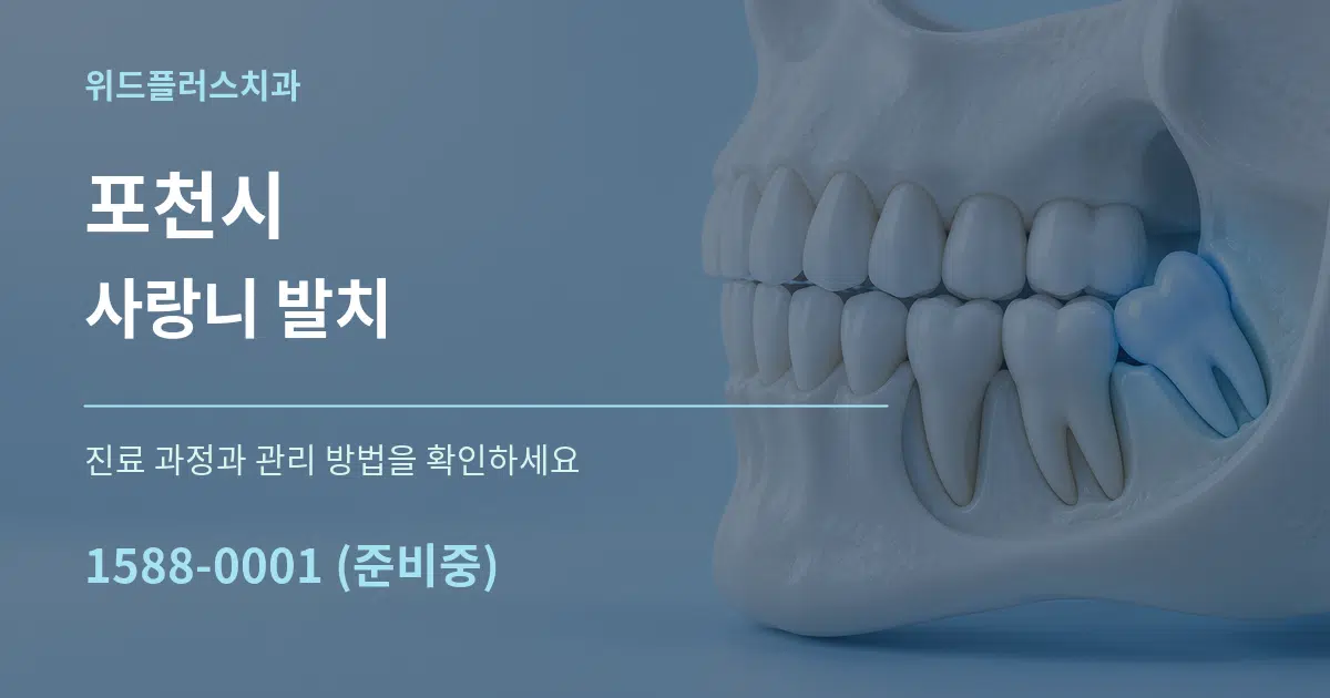 포천시 사랑니 발치 작업 조건 안내 그래픽