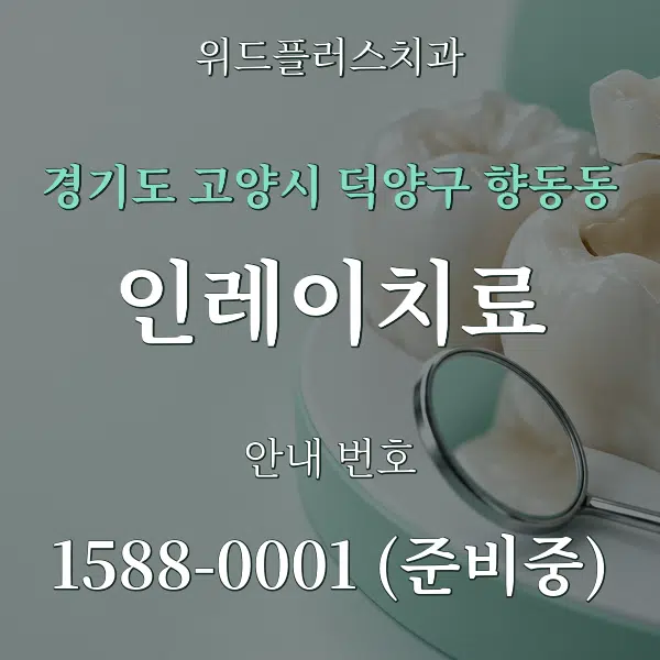 경기도 고양시 덕양구 향동동 인레이치료 대표 안내 그래픽