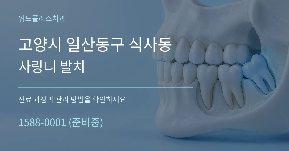 고양시 일산동구 식사동 사랑니 발치 작업 조건 안내 그래픽