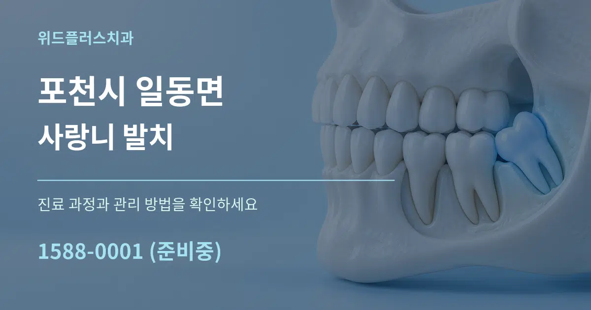 포천시 일동면 사랑니 발치 작업 조건 안내 그래픽