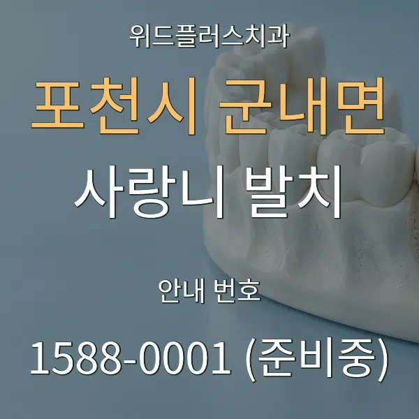 포천시 군내면 사랑니 발치 대표 안내 그래픽
