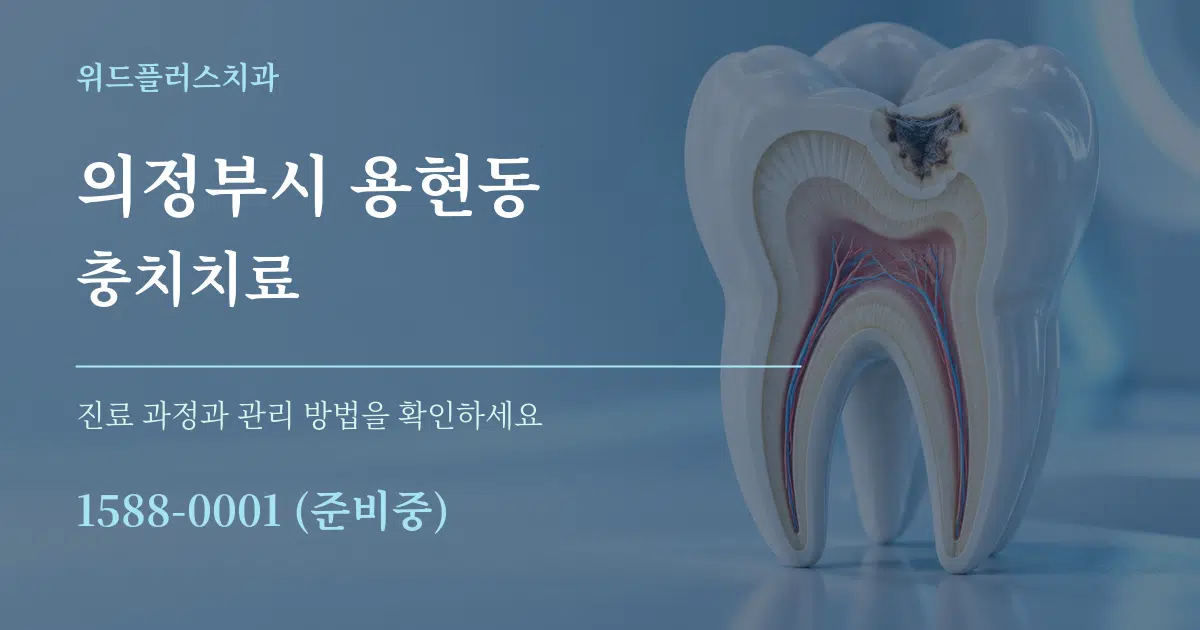 의정부시 용현동 충치치료 작업 조건 안내 그래픽