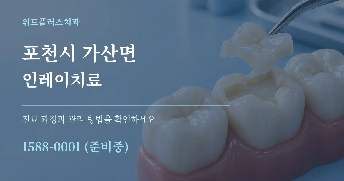 포천시 가산면 인레이치료 작업 조건 안내 그래픽
