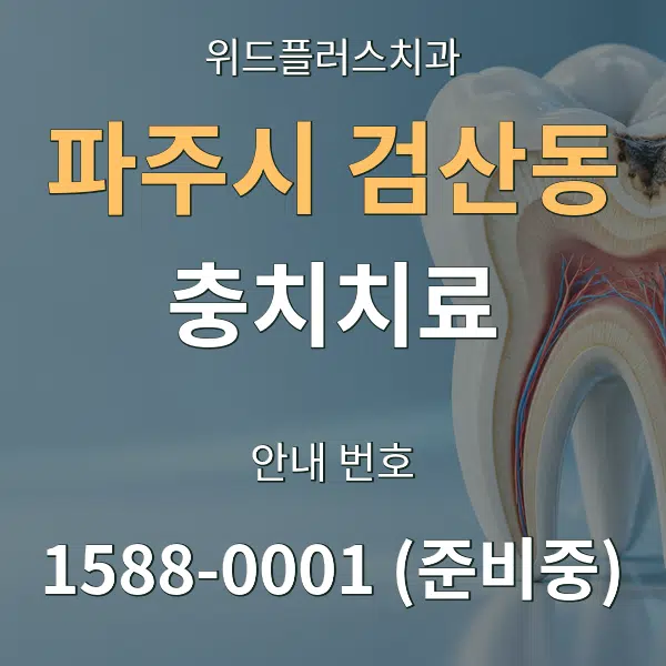 파주시 검산동 충치치료 대표 안내 그래픽