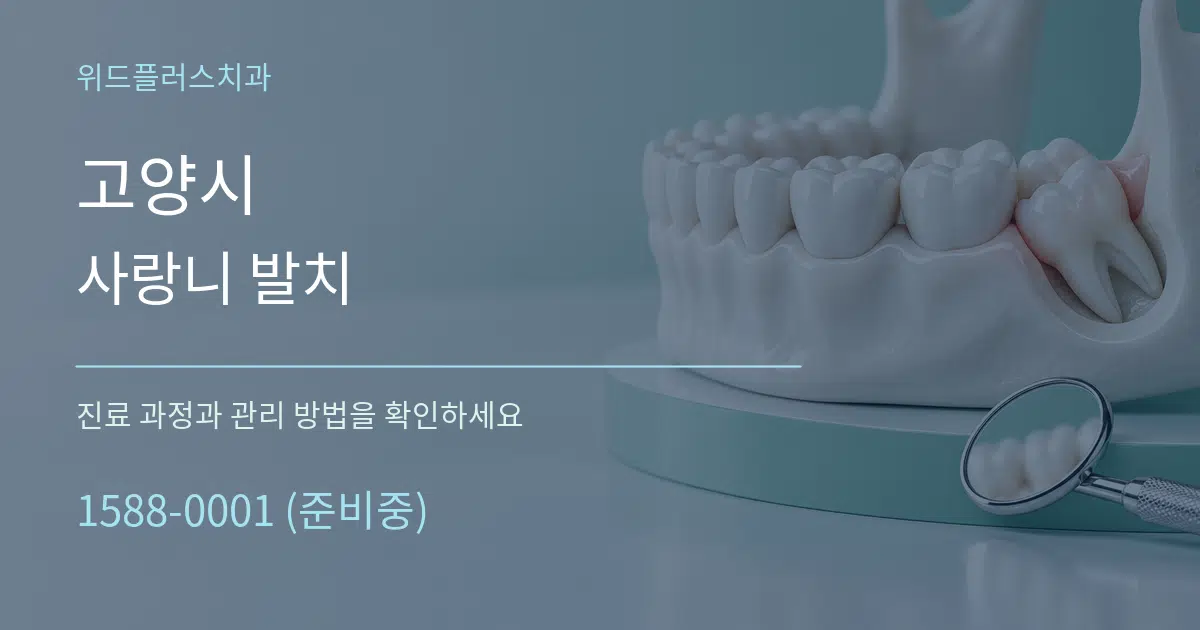 고양시 사랑니 발치 작업 조건 안내 그래픽