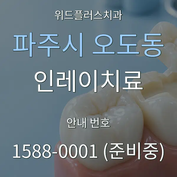 파주시 오도동 인레이치료 대표 안내 그래픽