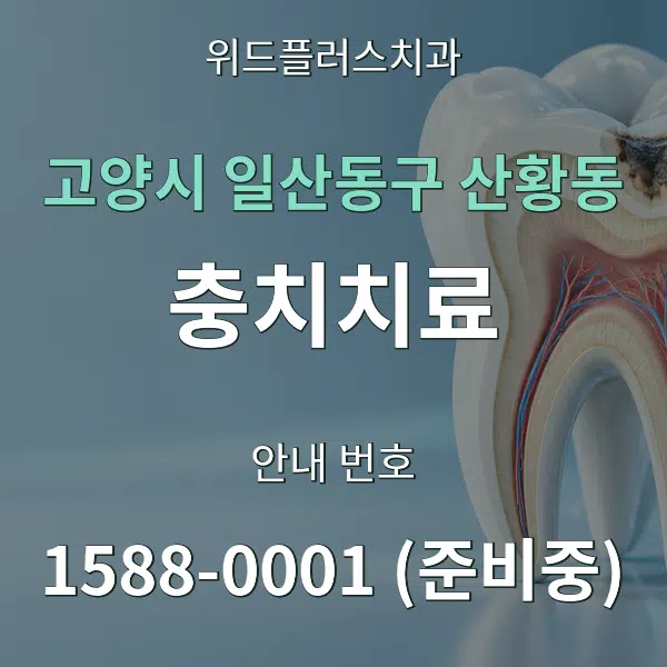고양시 일산동구 산황동 충치치료 대표 안내 그래픽