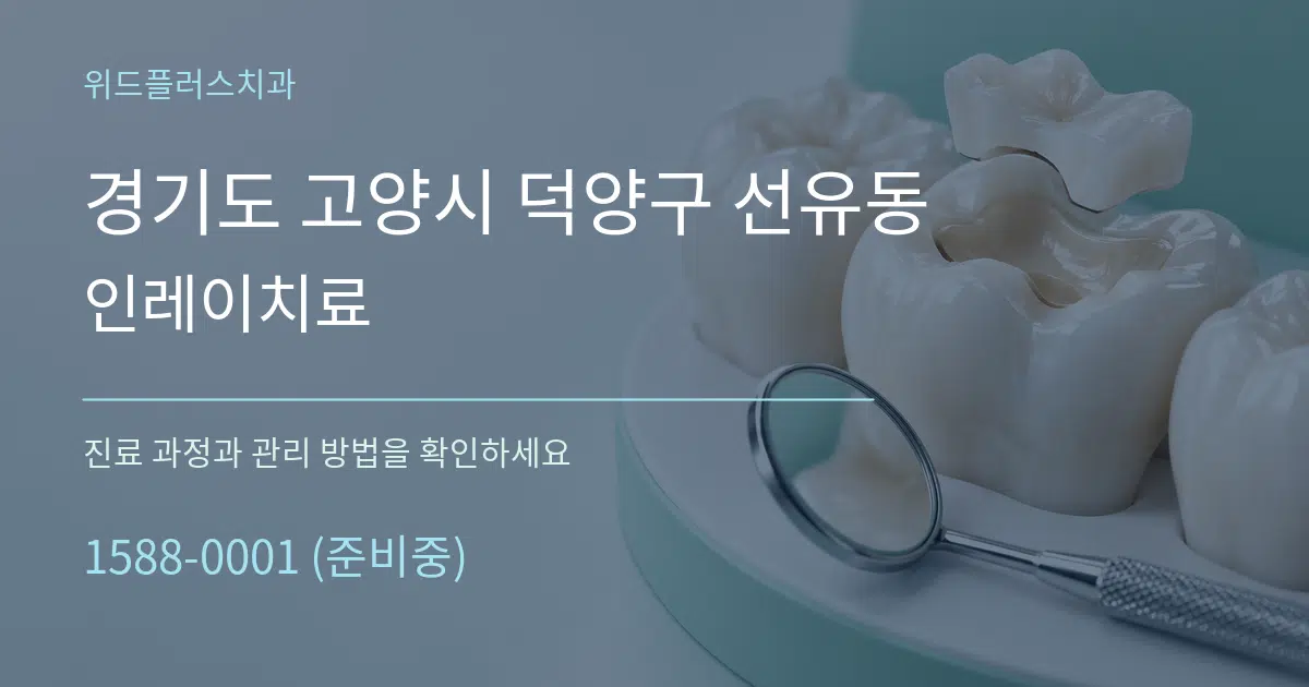 경기도 고양시 덕양구 선유동 인레이치료 서비스 이용 안내 그래픽