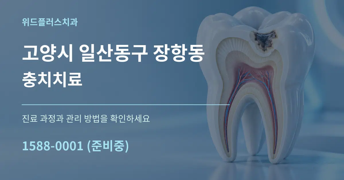 고양시 일산동구 장항동 충치치료 작업 조건 안내 그래픽