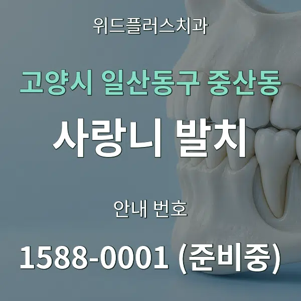 고양시 일산동구 중산동 사랑니 발치 대표 안내 그래픽