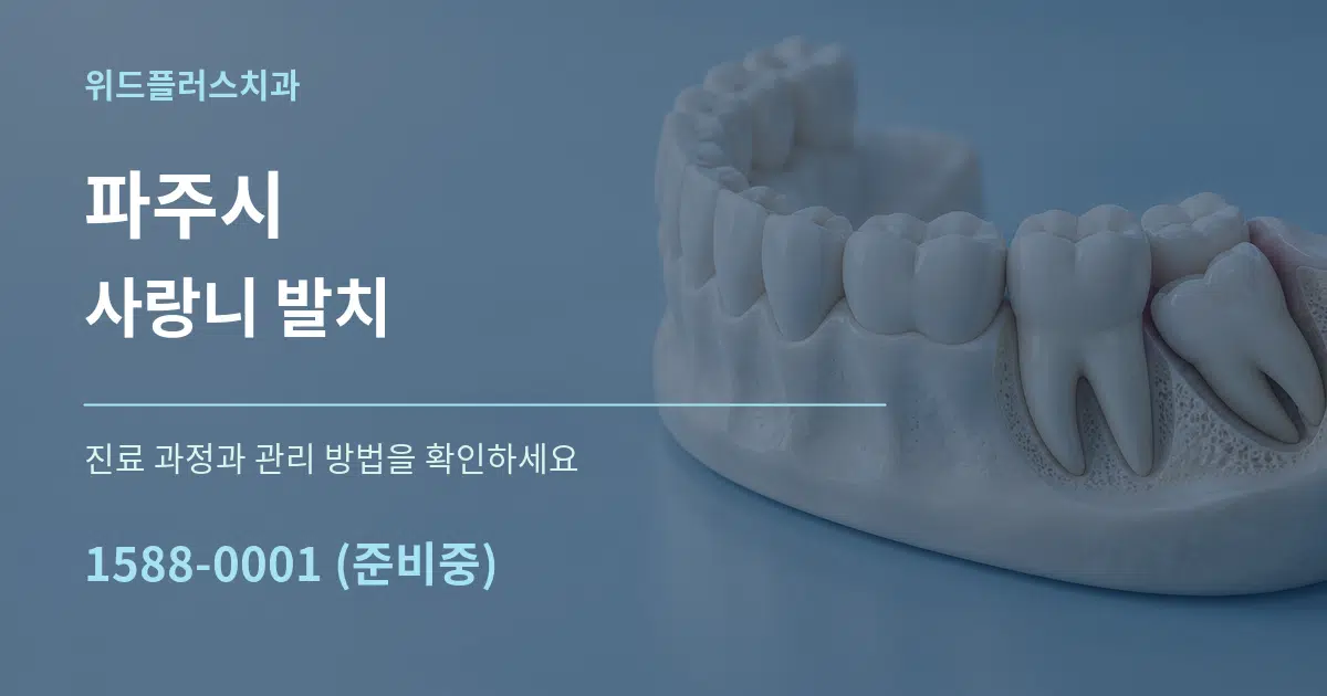 파주시 사랑니 발치 작업 조건 안내 그래픽