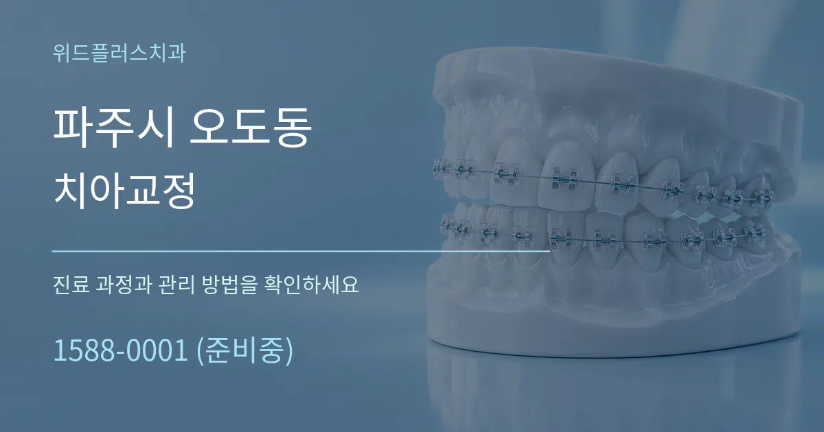 파주시 오도동 치아교정 작업 조건 안내 그래픽