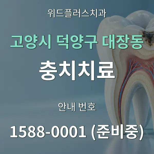 고양시 덕양구 대장동 충치치료 대표 안내 그래픽
