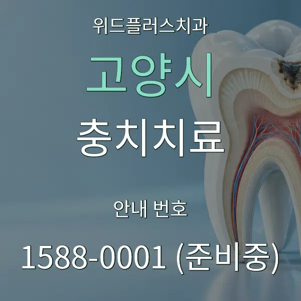 고양시 충치치료 대표 안내 그래픽