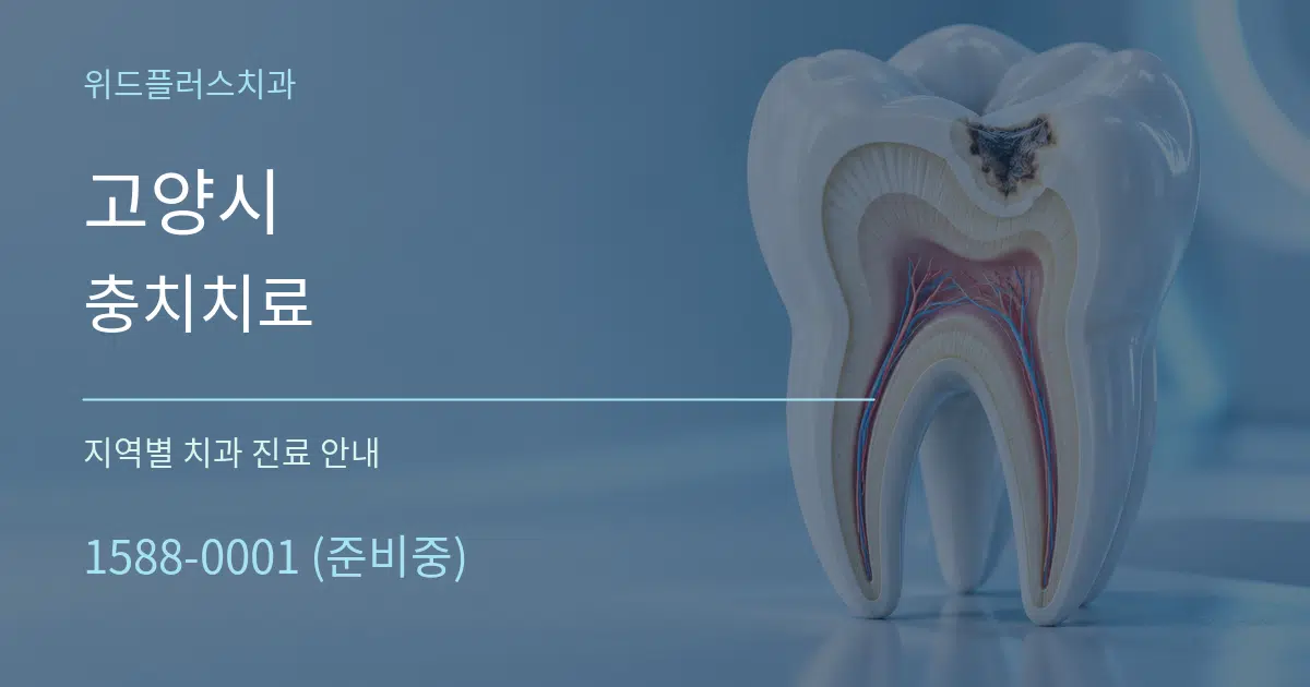 고양시 충치치료 대표 안내 그래픽
