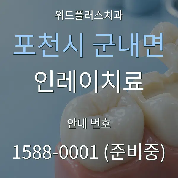 포천시 군내면 인레이치료 대표 안내 그래픽