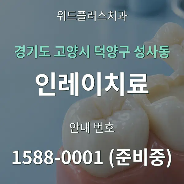 경기도 고양시 덕양구 성사동 인레이치료 대표 안내 그래픽