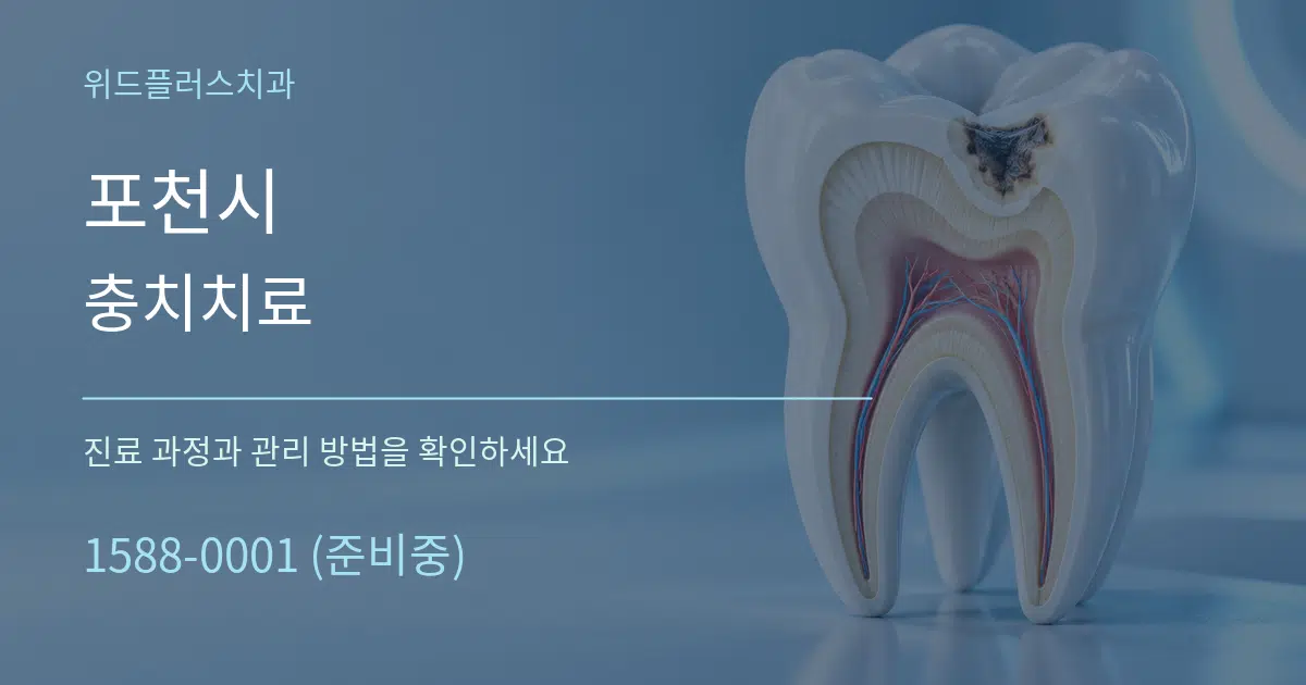 포천시 충치치료 작업 조건 안내 그래픽