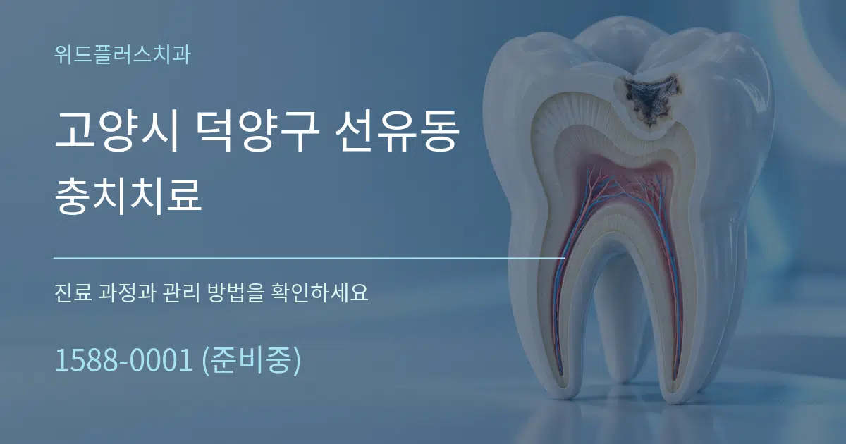 고양시 덕양구 선유동 충치치료 작업 조건 안내 그래픽