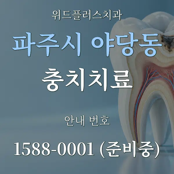 파주시 야당동 충치치료 대표 안내 그래픽