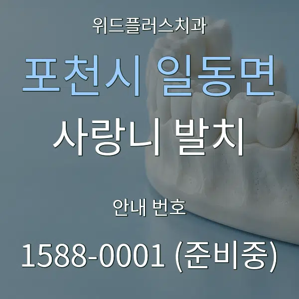 포천시 일동면 사랑니 발치 대표 안내 그래픽