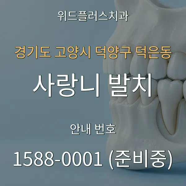 경기도 고양시 덕양구 덕은동 사랑니 발치 대표 안내 그래픽