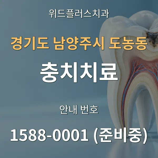 경기도 남양주시 도농동 충치치료 대표 안내 그래픽