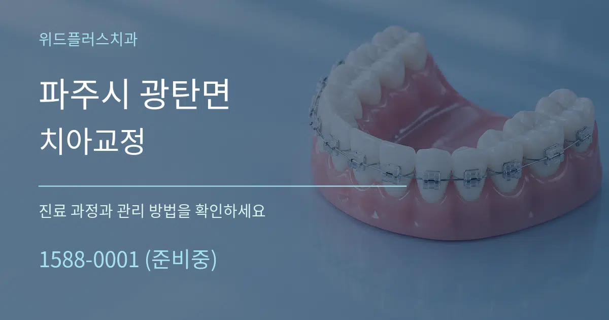 파주시 광탄면 치아교정 작업 조건 안내 그래픽
