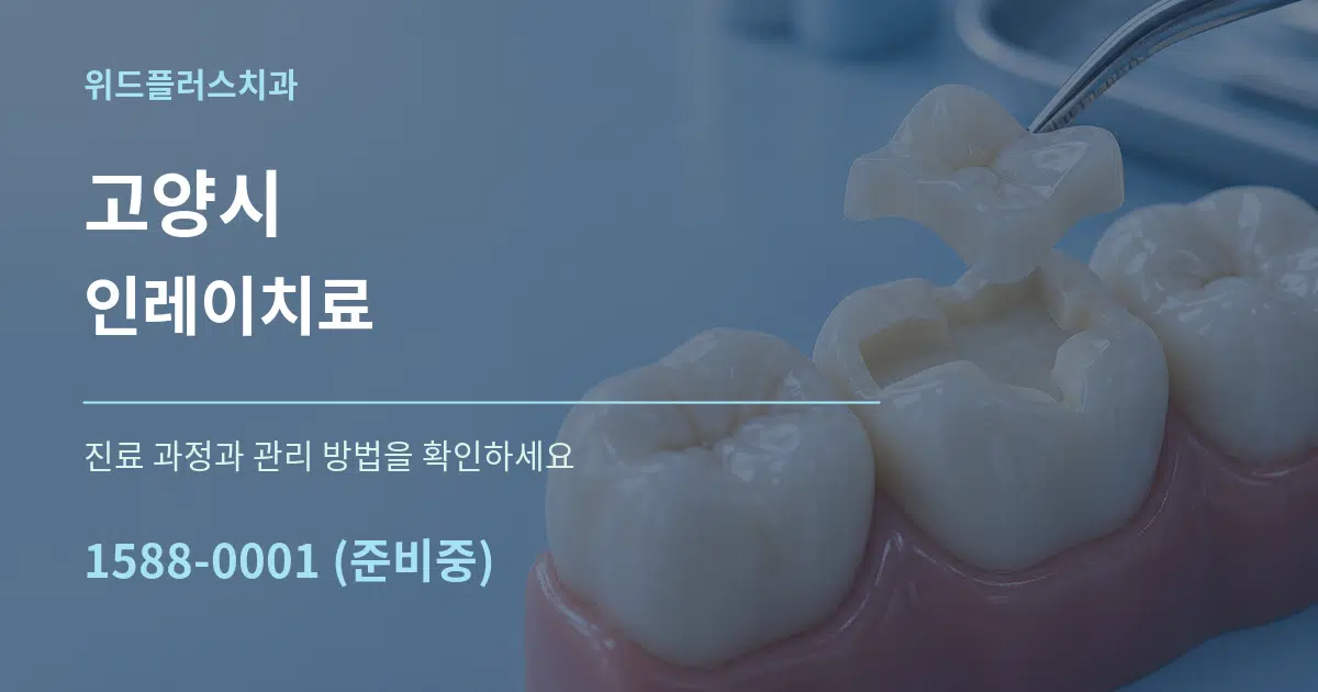 고양시 인레이치료 서비스 이용 안내 그래픽