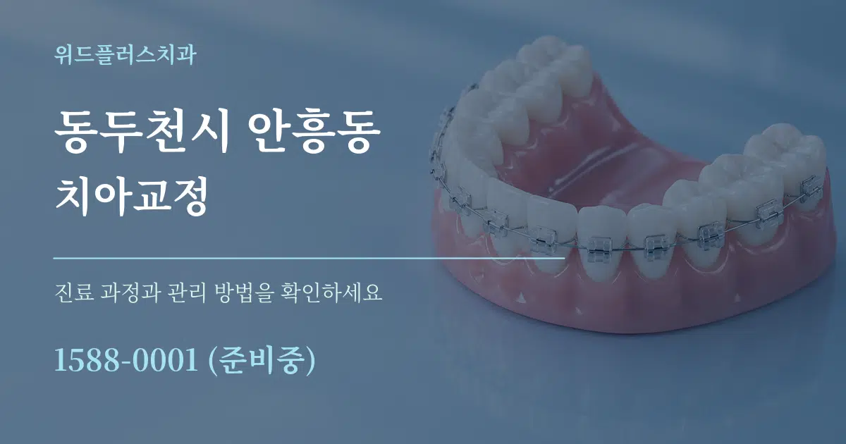 동두천시 안흥동 치아교정 작업 조건 안내 그래픽