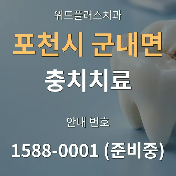 포천시 군내면 충치치료 대표 안내 그래픽