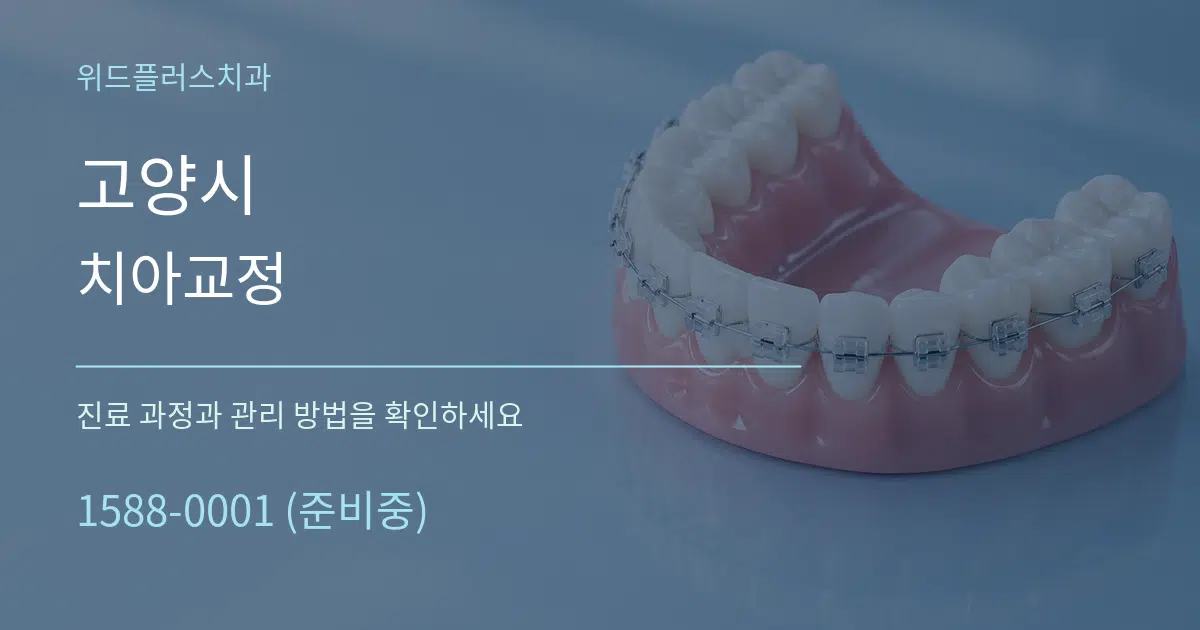 고양시 치아교정 서비스 이용 안내 그래픽