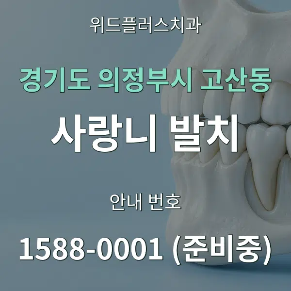 경기도 의정부시 고산동 사랑니 발치 대표 안내 그래픽